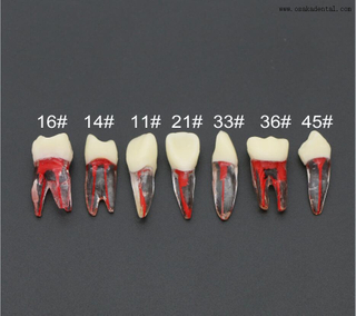 Modelo de Dentes de Prática para Uso de Estudantes de Dentista